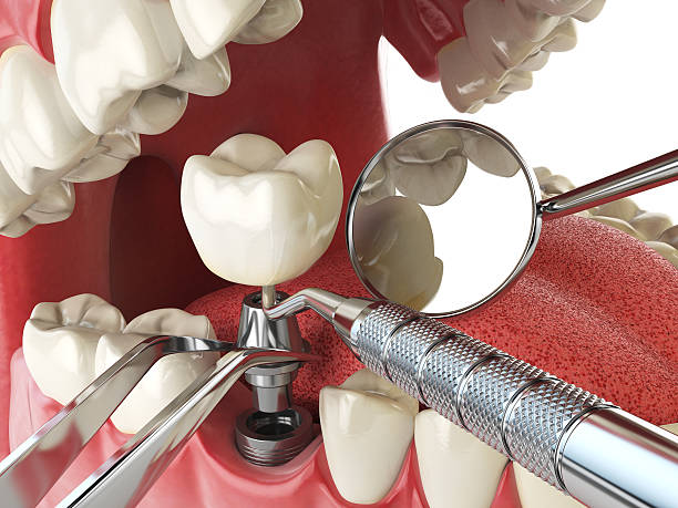 Best Emergency Wisdom Teeth Removal in Woodward, OK